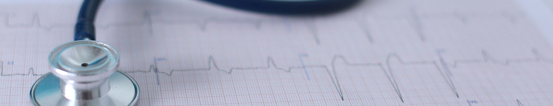 EKG