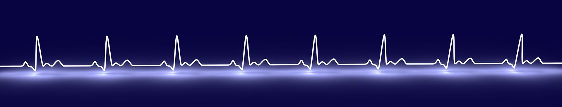 EKG